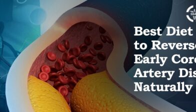 Best Diet to Reverse Early Coronary Artery Disease Naturally