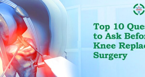 Top 10 Questions to Ask Before Total Knee Replacement Surgery